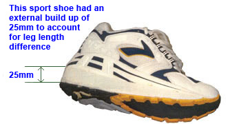 Modified_sports_shoe